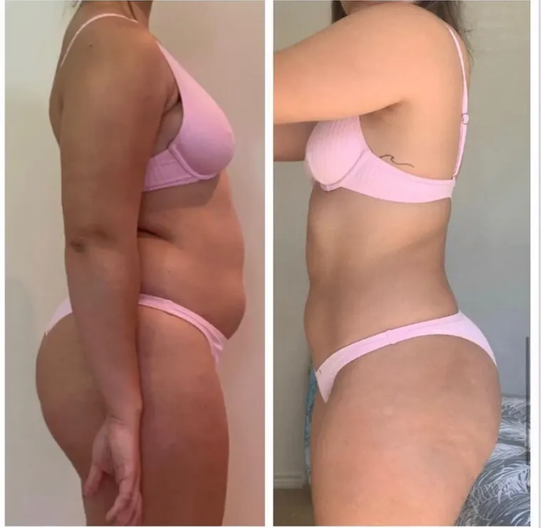 Antes e depois de aluna