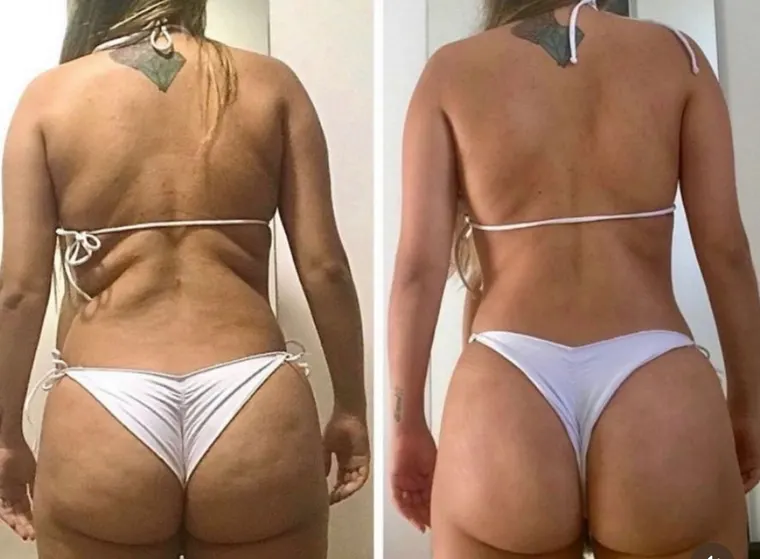 Antes e depois de aluna