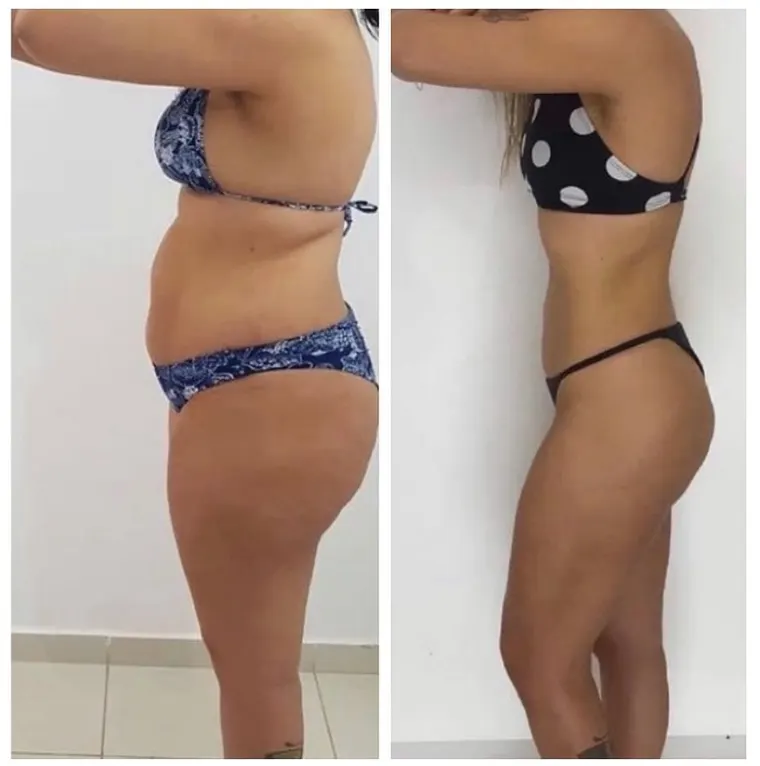 Antes e depois de aluna